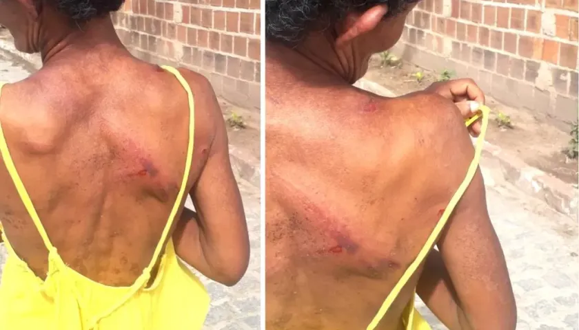 Homem é flagrado batendo na vizinha com pedaço de mangueira em Pernambuco