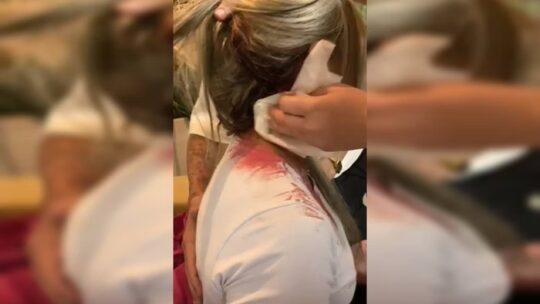 Mulher leva pedrada na cabeça em tentativa de assalto