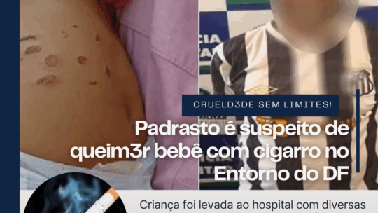 Padrasto é suspeito de queim3r bebê com cigarro no Entorno do DF